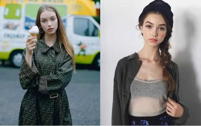 Josie Lane sinh năm 2001 tại Brighton, Anh từng nổi tiếng khắp thế giới khi là cô bé có nét đẹp của một thiên thần.