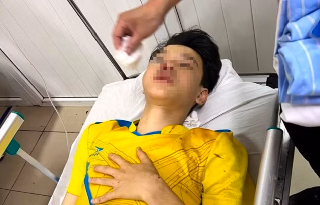 Khong may gap tai nan, thi sinh bo lo mon thi cuoi cung