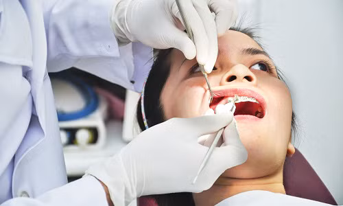 ThS.BS Nguyễn Vũ Trung, khoa Răng Hàm Mặt, BVĐK Hà Đông khuyến cáo không nên loại bỏ răng ở những thời điểm sau để tránh gặp những nguy hiểm khi nhổ răng. 