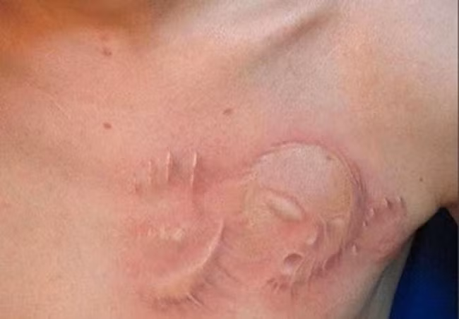 Người xem sẽ hoảng hốt vì hình xăm trông như quái vật đang bị giam giữ dưới da.