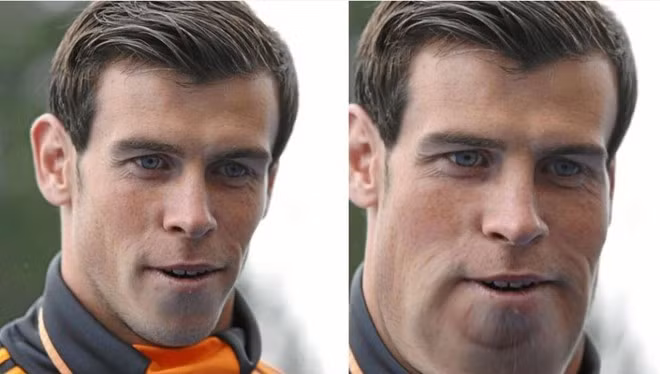 Gương mặt của Gareth Bale sẽ cân đối hơn nếu tăng cân.