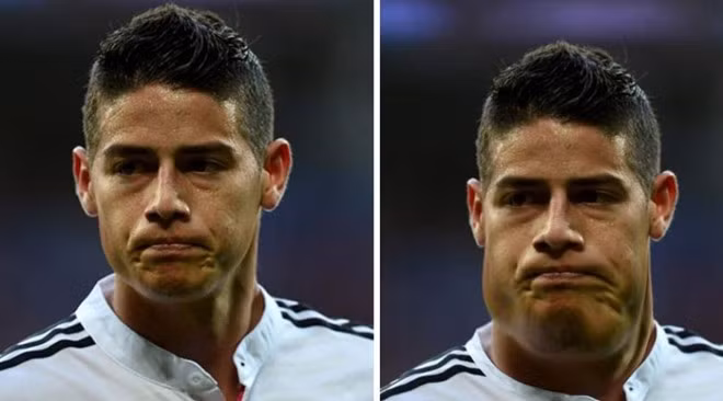 Tiền vệ James Rodriguez của Real Madrid béo không đều.