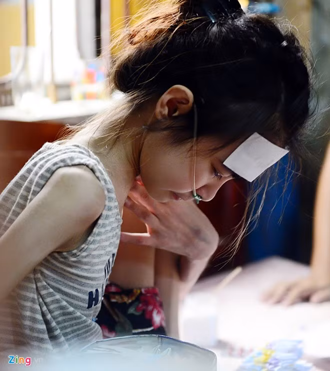 Nhắc lại những chuyện xưa, cô gái 17 tuổi không khỏi xúc động và rơi nước mắt. Nhi từng là nữ sinh hoạt bát, năng động. Bệnh tật đã làm em thu mình và suy nghĩ nhiều.