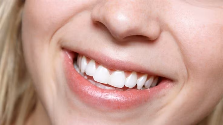 Ai trong chúng ta cũng có muốn có một hàm răng đều tăm tắp như các ngôi sao điện ảnh. Chỉ tìm kiếm trên mạng với từ khóa “ chỉnh răng tại nhà”, bạn sẽ nhận được vô số video hướng dẫn trên Youtube với hàng trăm ngàn lượt xem. Rất nhiều video trong số này hướng dẫn tự chỉnh răng bằng những đồ dùng rẻ tiền như chun buộc tóc, dây cao su, kẹp giấy và chỉ nha khoa. 