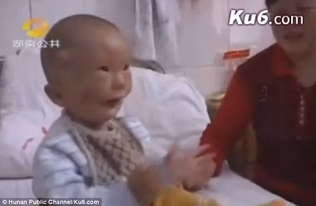 Sống trong một vùng nông thôn nghèo khó và vẫn quá truyền thống, gia đình bé Huikang đều bị hàng xóm trêu chọc và coi thường vì sinh ra một đứa con như Huikang. Đến năm 2010 khi đi khám ở bệnh viện Changsha thì trường hợp của Huikang mới được dư luận biết tới. 