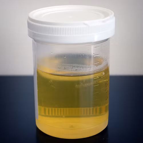 Trung bình một người nặng 60kg sẽ đi tiểu ra khoảng 60ml, nhưng nếu chỉ cần uống thêm một cốc bia thì lượng nước tiểu thải ra sẽ lên tới 120ml. Đi tiểu quá nhiều sẽ dẫn đến mất nước. (Ảnh: indiamart)