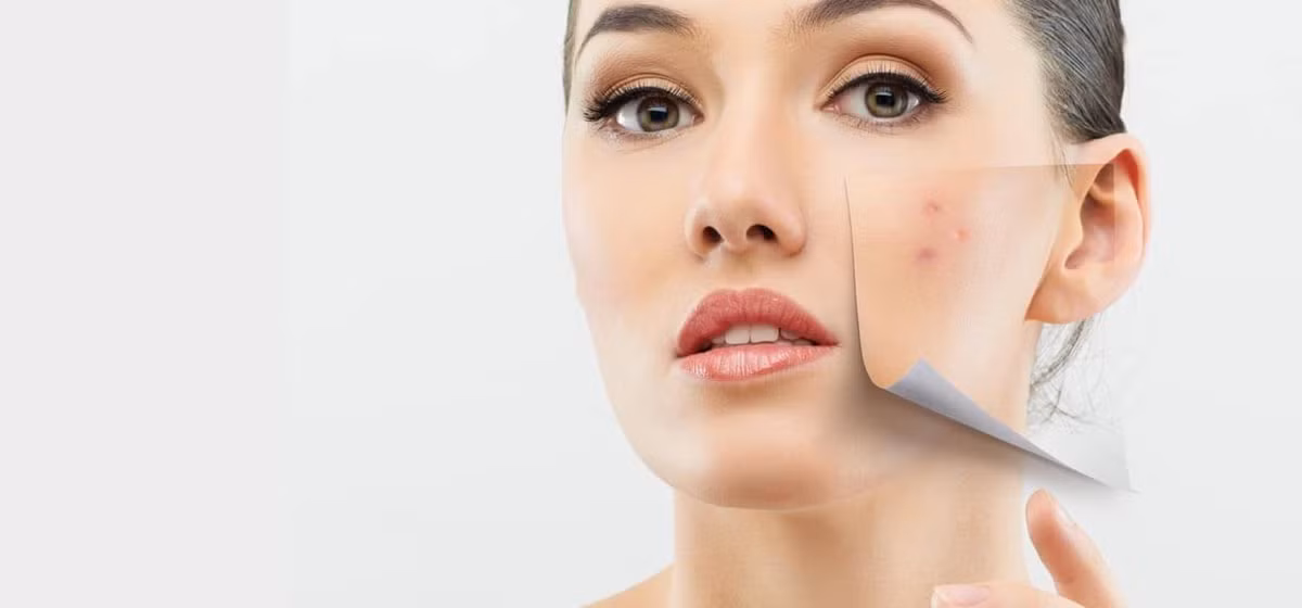 Ngoài ra, khi chăm sóc da tuổi 30 cần lưu ý da khô và nhạy cảm hơn. Nếu dùng kem trị mụn mạnh thì da sẽ bị khô và kích ứng. Nên chuyển sang các sản phẩm trị mụn dịu nhẹ hơn nhưng vẫn hiệu quả, chẳng hạn như có chứa sulfur. Ngoài ra còn cần thay đổi kem dưỡng ẩm sang loại dưỡng ẩm nhiều hơn, ví dụ dưỡng ẩm có chứa vitamin C. 