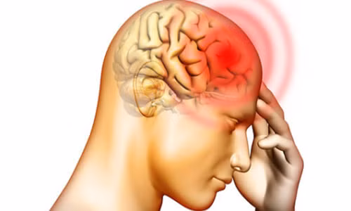 Để chữa đau đầu không cần thuốc, bạn dùng ngón trỏ và ngón giữa đặt vào huyệt ấn đường, siết nhẹ khoảng vài giây rồi buông ra. Cứ thế lặp lại khoảng một phút. 