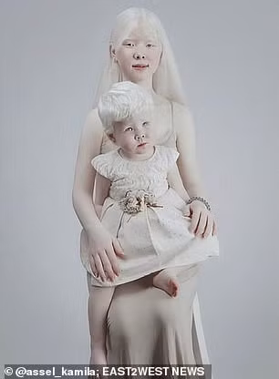 Tuy nhiên, cũng chính nhờ diện mạo khác biệt, Asel đã bắt đầu được mời làm người mẫu từ năm lên 10 tuổi. Hiện tại, tài khoản mạng xã hội mang tên Asel đã có tới 23.800 lượt theo dõi.