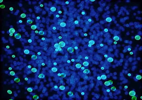 Kết quả nghiên cứu sơ bộ cho thấy bắt mirusvirus có thể liên quan đến nhóm virus lớn có tên là Duplodnaviria, bao gồm nhóm virus quen thuộc herpes lây nhiễm cho động vật và con người dựa trên các gen mã hóa chung cho lớp vỏ.