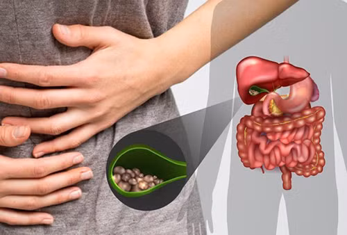 Theo thời gian có thể gây sỏi mật, viêm túi mật, ung thư túi mật. Để có lợi cho sức khỏe, chuyên gia khuyên nên ưu tiên rau củ tươi cho bữa sáng. Những loại rau họ cải như bắp cải, rau xanh đậm, rau màu cam, đậu, hành, cà chua, trái cây tươi,... không chỉ chứa nhiều dưỡng chất mà còn có lượng lớn chất xơ, rất có lợi cho nhu động ruột.