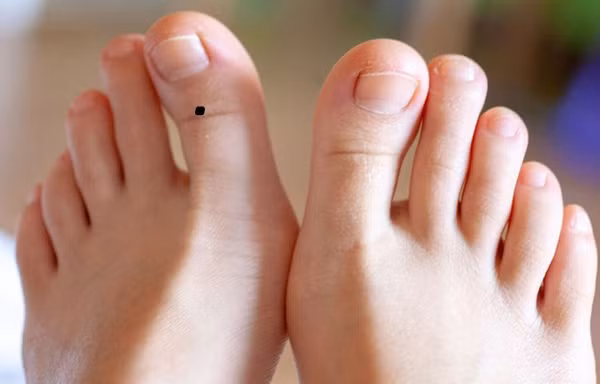 Nốt ruồi ở ngón chân cái. Nếu bạn sở hữu một nốt ruồi ở ngón chân cái được xem là ngón trụ cột trên bàn chân. Một người khi sở hữu nốt ruồi này thường dễ nắm được quyền lực trong công việc. Những người phụ nữ này thường có khả năng lãnh đạo xuất chúng tài tình. 