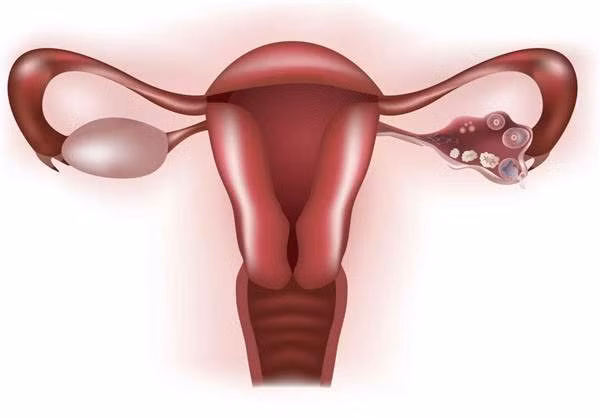 Buồng trứng của bạn chính là nơi sản xuất ra các hormon progesterone và estrogen cho cơ thể. Nó cũng có tác động đến ham muốn tình dục, chu kỳ kinh nguyệt của chị em.