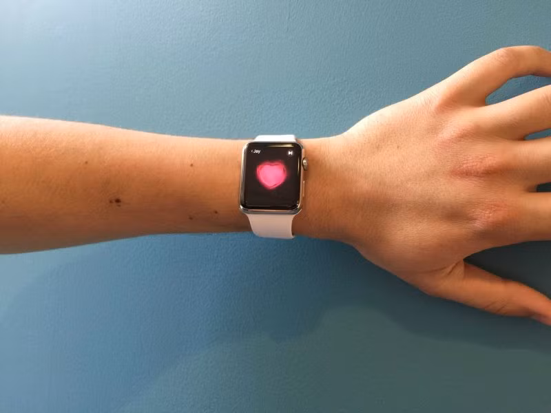 Khiến iPhone hao pin nhanh chóng: Bởi chiếc Apple Watch buộc phải kết nối liên tục với iPhone, nó sẽ là tác nhân khiến pin smartphone hao đi nhanh chóng. Một vài người cho rằng chiếc Watch sẽ cải thiện phần nào tuổi thọ pin của thiết bị vì nó khiến người dùng ít phải mở máy ra xem; nhưng đại đa phần người dùng đều than phiền nó khiến pin iPhone sụt nhanh rõ rệt.