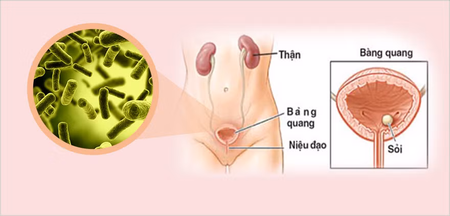 1. Chữa viêm thận và viêm bàng quang: Râu Ngô 100g, rau má 50g, ý dĩ 50g, sài đất 40g, mã đề 50g, nước 600ml sắc còn 250ml. Ngày uống 3 lần, mỗi lần cách nhau 3-4 giờ. Ảnh: namkhoahiemmuon.com.