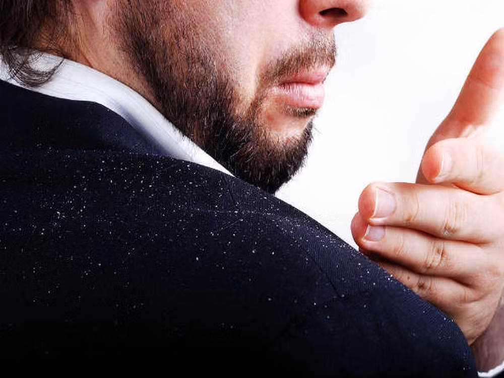 Ngăn ngừa gàu: Tán bột vỏ quả lựu, trộn với dầu dừa ấm. Bôi hỗn hợp này lên da đầu và để 15 phút. Gội đầu với nước lạnh. Bạn sẽ thấy tác dụng của hỗn hợp này. Ảnh: baomoi.com.