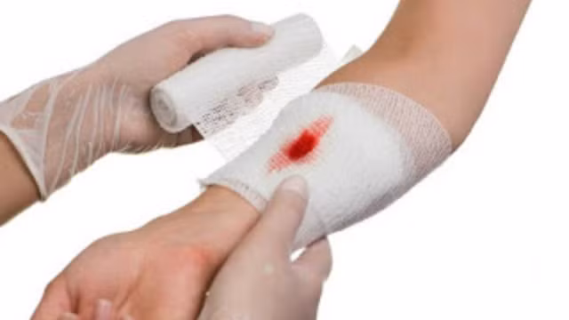 6. Chữa vết thương hay phong thấp đau nhức: Dùng huyết dụ (cả lá, hoa, rễ) 30g, huyết giác 15g, sắc uống ngày 1 thang, chia 2 – 3 lần. Ảnh: Nacurgo.com.