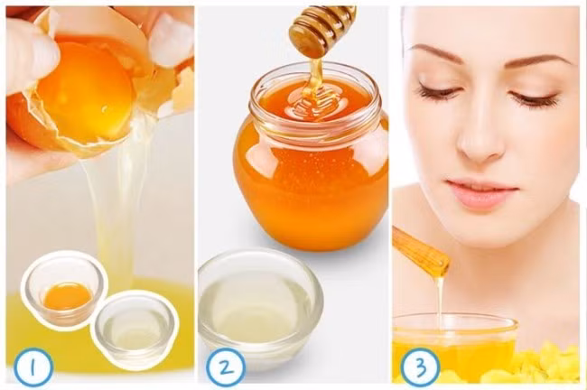 Trứng gà kết hợp với mật ong chắc chắn sẽ đem lại hiệu quả trị nám vô cùng bất ngờ. Ảnh: camnangsuckhoe365.