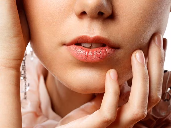  Không chăm sóc môi: Đôi môi cũng cần được chăm sóc kỹ lưỡng như da mặt trong mùa hè. Không chăm sóc hợp lý có thể khiến cho đôi môi bị khô, nứt nẻ. Thoa son dưỡng môi cả ngày hoặc son dưỡng chứa SPF để dưỡng ẩm và chống nắng cho môi.