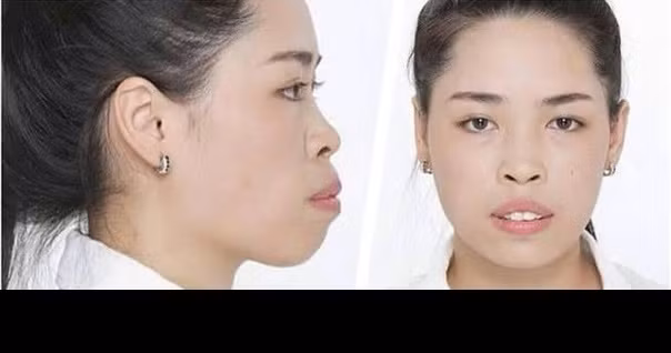 May mắn đến với Thanh Quỳnh khi cô được lựa chọn làm nhân vật của chương trình "Thay đổi cuộc sống" - "Change Life", được sang Hàn Quốc phẫu thuật thẩm mỹ miễn phí.