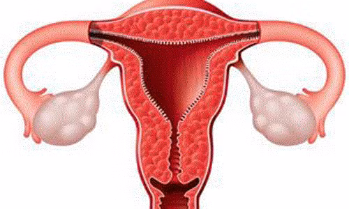  Mắc ung thư cổ tử cung do lây nhiễm virus HPV. Đa số các trường hợp bị ung thư cổ tử cung đều là do bị nhiễm virus HPV trong nhiều năm. Theo thống kê thì virus HPV có khoảng 100 chủng loại khác nhau, trong đó có khoảng 40 loại gây ra các bệnh liên quan đến hậu môn và bộ phận sinh dục và có 15 loại được liệt vào hàng nguy hiểm, có nguy cơ gây ung thư cao.