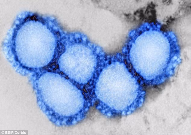 Canh bao virus giong SARS co the gay dai dich sau Ebola