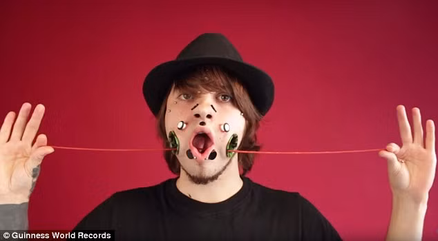 Joel Miggler, 23 tuổi, một chàng trai làm nghề người mẫu tại Đức có cách làm đẹp kỳ quặc khiến nhiều người phải sợ hãi. Anh nói rằng anh là một người đam mê body art (nghệ thuật trên cơ thể người), và những lỗ hổng đó cũng là một tác phẩm nghệ thuật của anh.