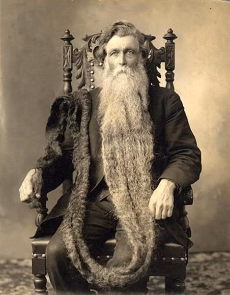 Năm 1567, người đàn ông có tên Hans Steininger có bộ râu dài nhất thế giới. Ông mất mạng do dẫm lên bộ râu dẫn đến vấp ngã và gãy cổ trong lúc chạy thoát thân khi xảy ra hỏa hoạn. Sự thật đáng kinh ngạc này khiến nhiều người cảm thấy khó tin.