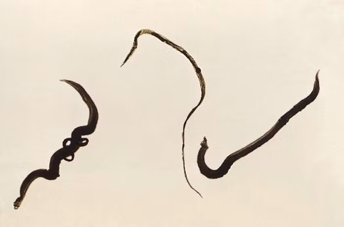 Sán Schistosoma mansoni được ghi nhận có ở châu Phi, Trung Đông, Caribbean, Brazil, Venezuela. Ảnh ppdictionary.