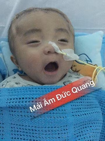 Những hình ảnh mới nhất về em bé Đức Lộc được đăng tải trên fanpage "Mái ấm Đức Quang". (Ảnh: FB).