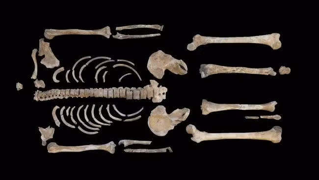 Trong nghiên cứu mới công bố trên International Journal of Osteoarchaeology, các nhà khoa học đã có phát hiện mới về bộ hài cốt của chiến binh Celtic được tìm thấy bên dưới gò đất lớn tại ngọn đồi tiền sử Heuneburg ở miền nam nước Đức. Ảnh: M. Francken / University of Tuebingen.