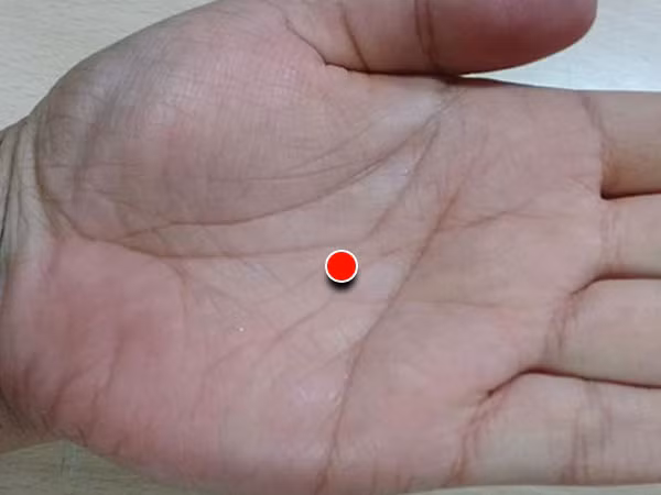 Lòng bàn tay. Dùng ngón tay nhấn nhẹ vào điểm trên lòng bàn tay, điểm này được coi như là một kinh tuyến quan trọng vì nó được cho là có ảnh hưởng đến tuyến tụy, gan và tim.