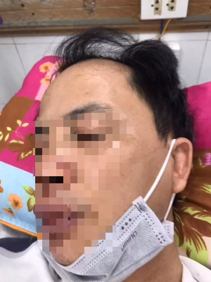 Khi đó, Tùng và Mạnh đã đánh anh Tuấn Anh. Sau đó, ông Hanh vào can ngăn đã bị Tùng và Mạnh đã đẩy và đá. Khi ông Hanh bỏ chạy, Mạnh đuổi theo dùng tay đẩy ngã ngồi xuống ven đường và dùng chân trái đá vào vùng mặt anh Hanh.