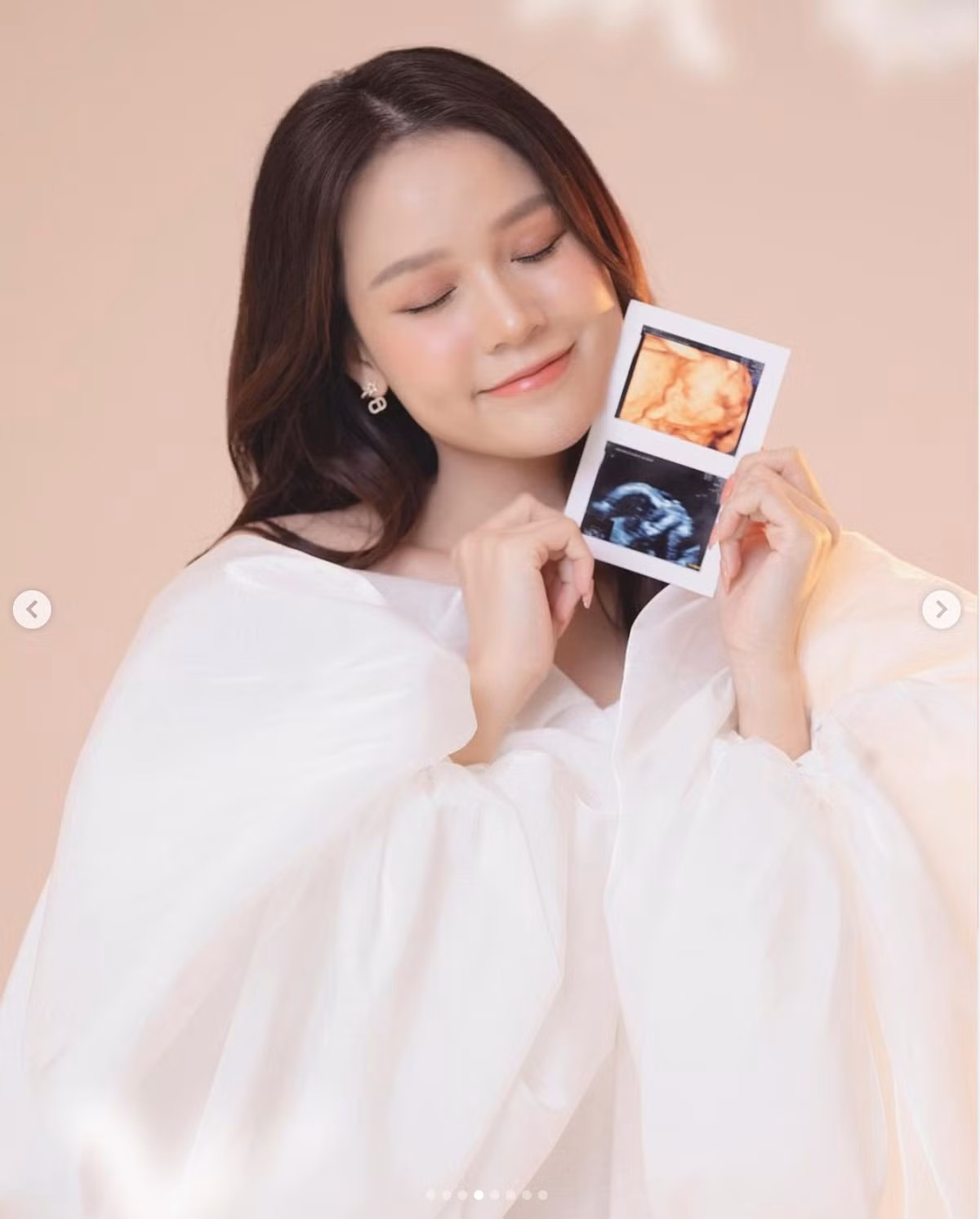 Được biết người đẹp đang mang thai ở tháng thứ 4. Suốt 3 tháng đầu thai kỳ, cô ốm nghén nhiều. Hiện tại, sức khỏe của cô đã ổn định hơn.