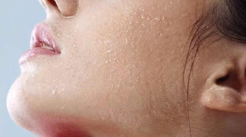 Khi làn da bị sần sùi sẽ rất nhạy cảm, dễ bị kích ứng và lên mụn. Điều này cũng phản ảnh rằng làn da của bạn đang không khỏe và đang bị thừa quá nhiều tế bào chết. Nếu không chăm sóc kịp thời và đúng cách thì những vết nứt của bề mặt da càng sâu và làm cho da bị lão hóa nhanh hơn. Ảnh minh họa