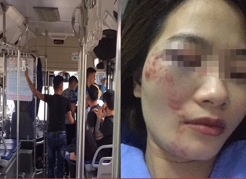 Khoi to vu an nhom thanh nien danh nu phu xe buyt nhap vien
