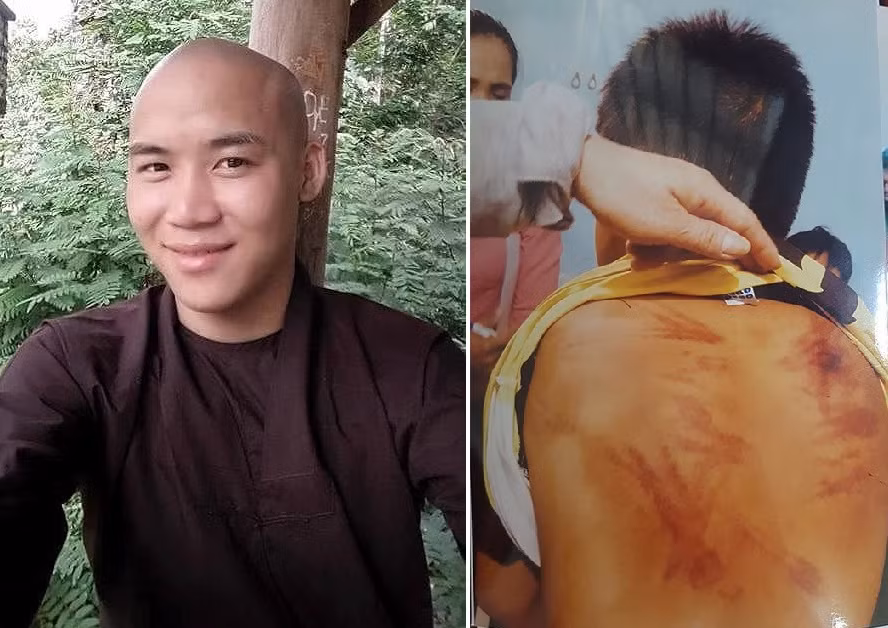 Giam dinh thuong tat chau be to thay tu danh dap, xam hai tinh duc