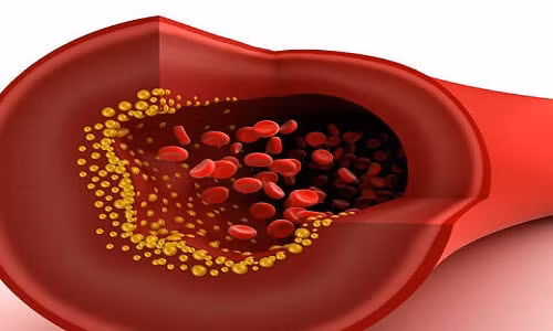 3. Giúp điều chỉnh Cholesterol trong cơ thể Cây kế sữa có lợi cho sức khỏe tim mạch và giúp điều chỉnh nồng độ cholesterol bằng cách giảm viêm, làm sạch máu và ngăn ngừa tổn thương oxy hóa trong các động mạch.