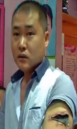 Cai ket dang cho trai tre tu xoa hinh xam de tiet kiem-Hinh-2