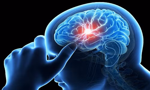 6. Có lợi cho não Hạt cau giúp cải thiện thần kinh và kiểm soát cơ bắp cho những bệnh nhân não. Tuy nhiên cũng có thể có tác dụng không mong muốn khi sử dụng với các loại thuốc khác. (Ảnh: VietNamNet)