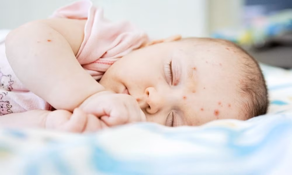 Trẻ bị ngứa toàn thân thì dùng nước đó để tắm cho trẻ liên tiếp trong 3 đến 7 ngày sẽ có hiệu quả. Ảnh: Con là tất cả.