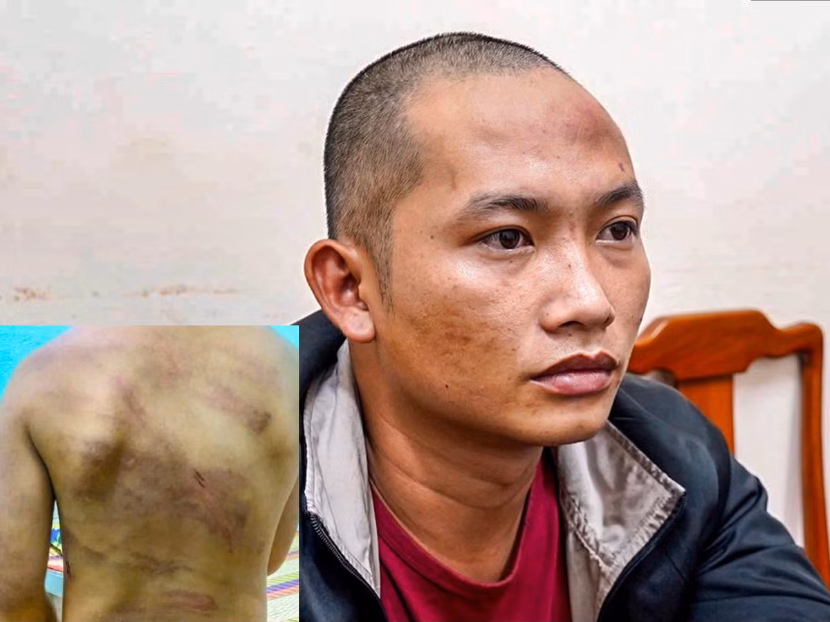 Tin nong 29/7: Nguoi phu nu bi chong cu tat nuoc soi-Hinh-2