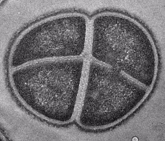 Deinococcus radiodurans trung hòa các phân tử oxy phản ứng (ROS) trước khi chúng gây hại, nhờ đó sống sót trong môi trường khắc nghiệt như vũ trụ hoặc lò phản ứng hạt nhân.(Ảnh: ScienceAlert)