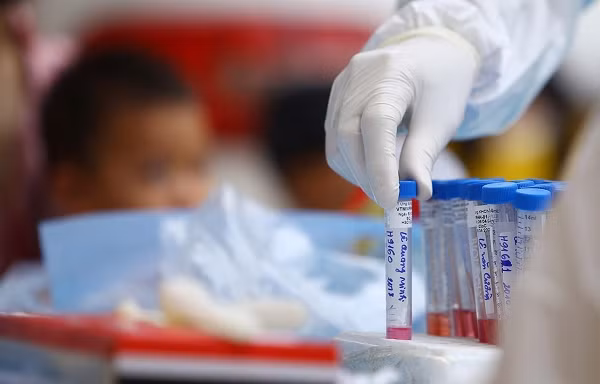 Một nghiên cứu gần đây của Pháp cho thấy, những con chó được huấn luyện đã ngửi được sự khác biệt giữa mồ hôi nách của những người khỏe mạnh và những người có COVID-19 với độ chính xác là 95%.