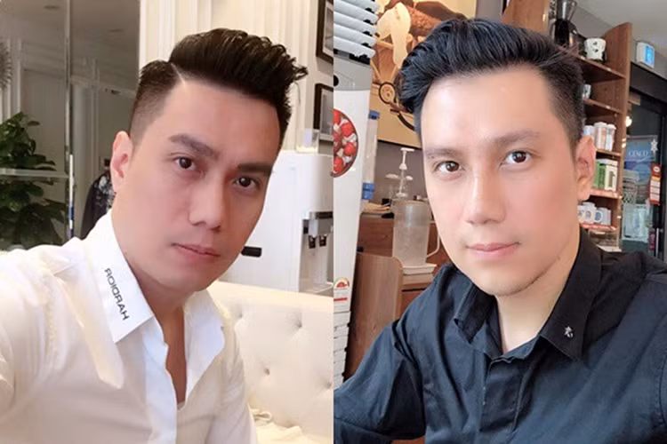 Khi mới dao kéo, gương mặt của Việt Anh bị nhiều người chê mất vẻ nam tính, thậm chí cứng đơ, kém tự nhiên.
