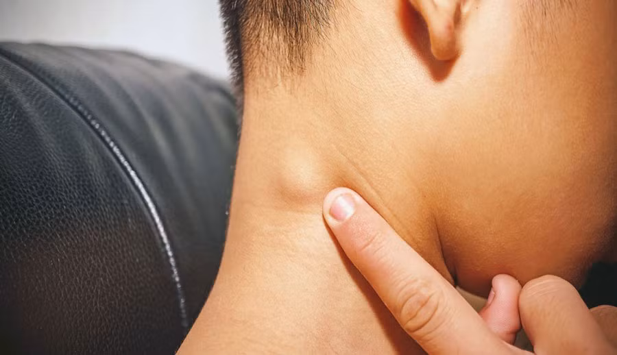 Bệnh nhân sẽ thường xuyên xuất hiện triệu chứng nhiễm trùng trong hệ thống thần kinh trung ương, có thể viêm màng não hoặc u nang não. Ảnh: nhathuocthanthien.