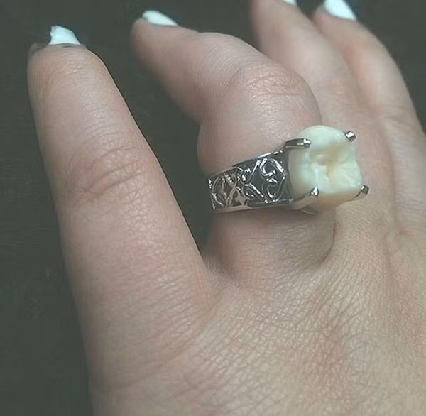Nhẫn có một không hai này được đính một chiếc răng khôn lấy từ miệng chồng tương lai của Carlee Leifkes và chế tác thay cho một viên kim cương. Ảnh: Boredpanda.