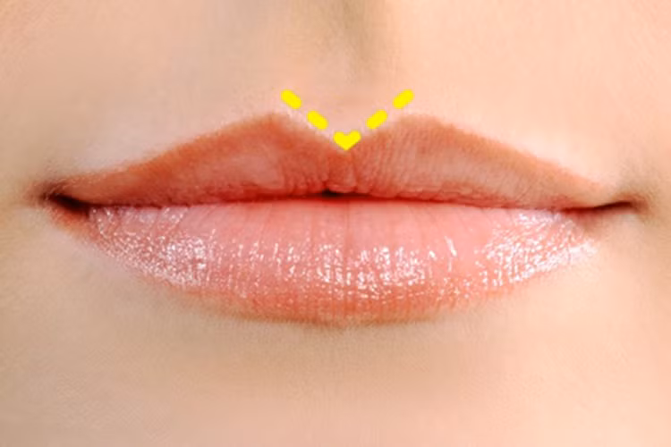 6. Môi trên và nhân trung tạo thành chữ V Những người này có sức sáng tạo mạnh mẽ, họ thường là những nghệ sĩ hay nhạc sĩ. Họ có một trí nhớ tốt và luôn giữ liên lạc với mọi mối quan hệ. Họ rất hòa đồng, thích thể hiện bản thân và trong đa số trường hợp, họ luôn đạt kết quả tốt. 