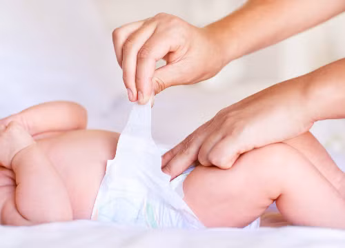 Trên 6 giờ trẻ không làm ướt một chiếc tã. Môi khô, nhìn trẻ mệt mỏi, lờ đờ chứng tỏ chúng đang trong tình trạng mất nước trầm trọng.