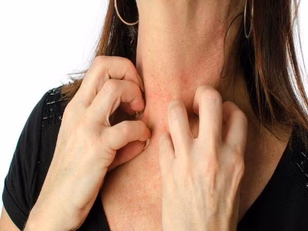 Suy thận khiến chất độc tích tụ trong cơ thể bạn tăng lên, những độc tố này có thể ảnh hưởng và khiến bạn bị ngứa ngáy, phát ban.